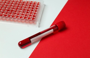 фото анализа на ферритин