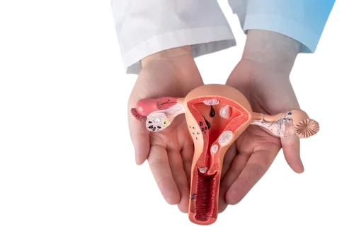 врач с манекеном женской матки с эндометриозом