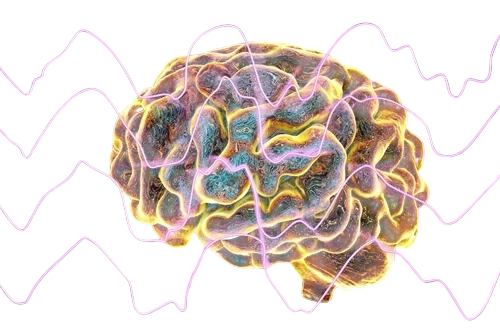 рисунок человеческого мозга во время эпилепсии