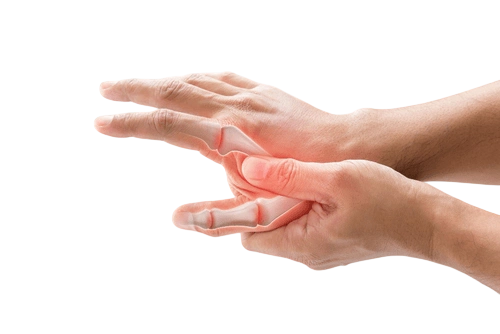 женские руки с артритом